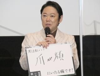 阿部サダヲ、サイコキラー役で名言「晴れ時々殺人みたいな」 爪が顔に見える“病”も告白